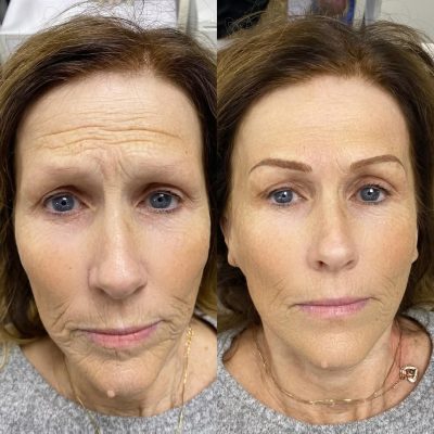 Microblading and Powder Brow